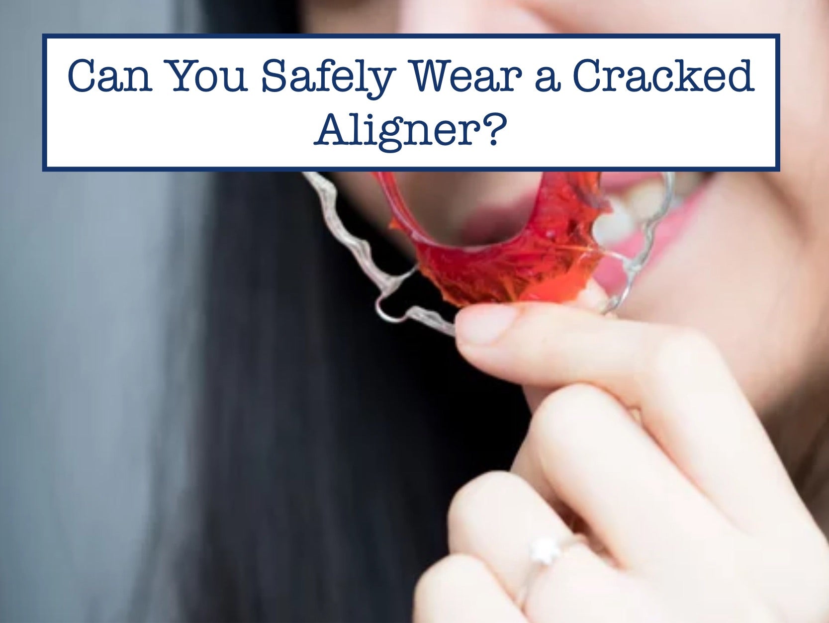 Can You Safely Wear a Cracked Aligner? – B.WEISS Health