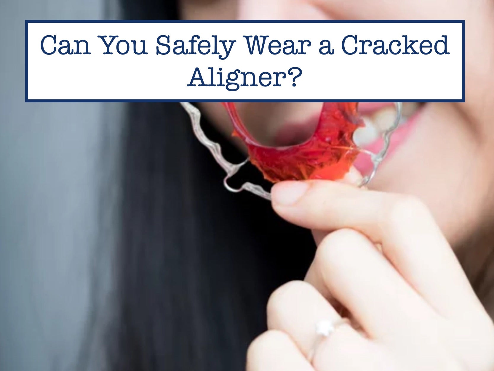 Can You Safely Wear a Cracked Aligner?