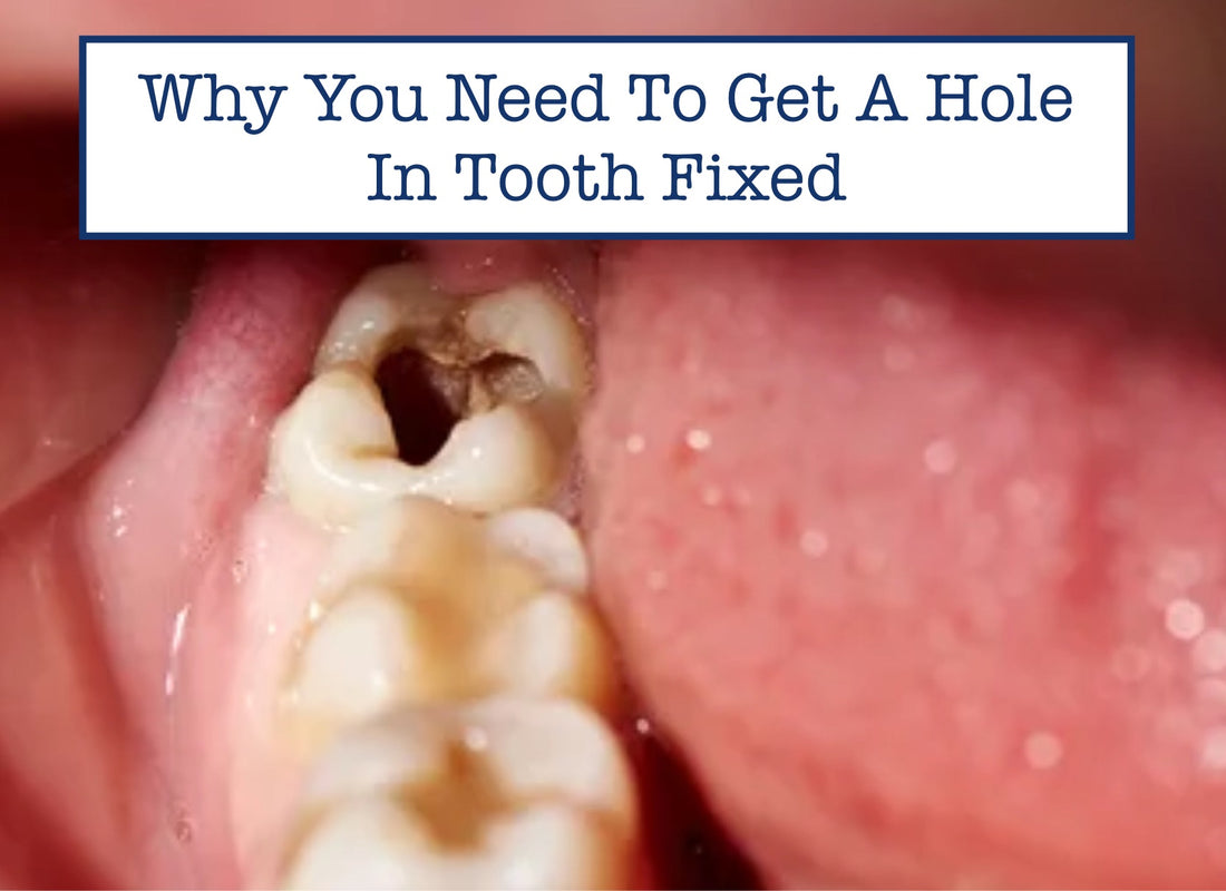 Why You Need To Get A Hole In Tooth Fixed