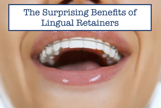  Lingual Retainers