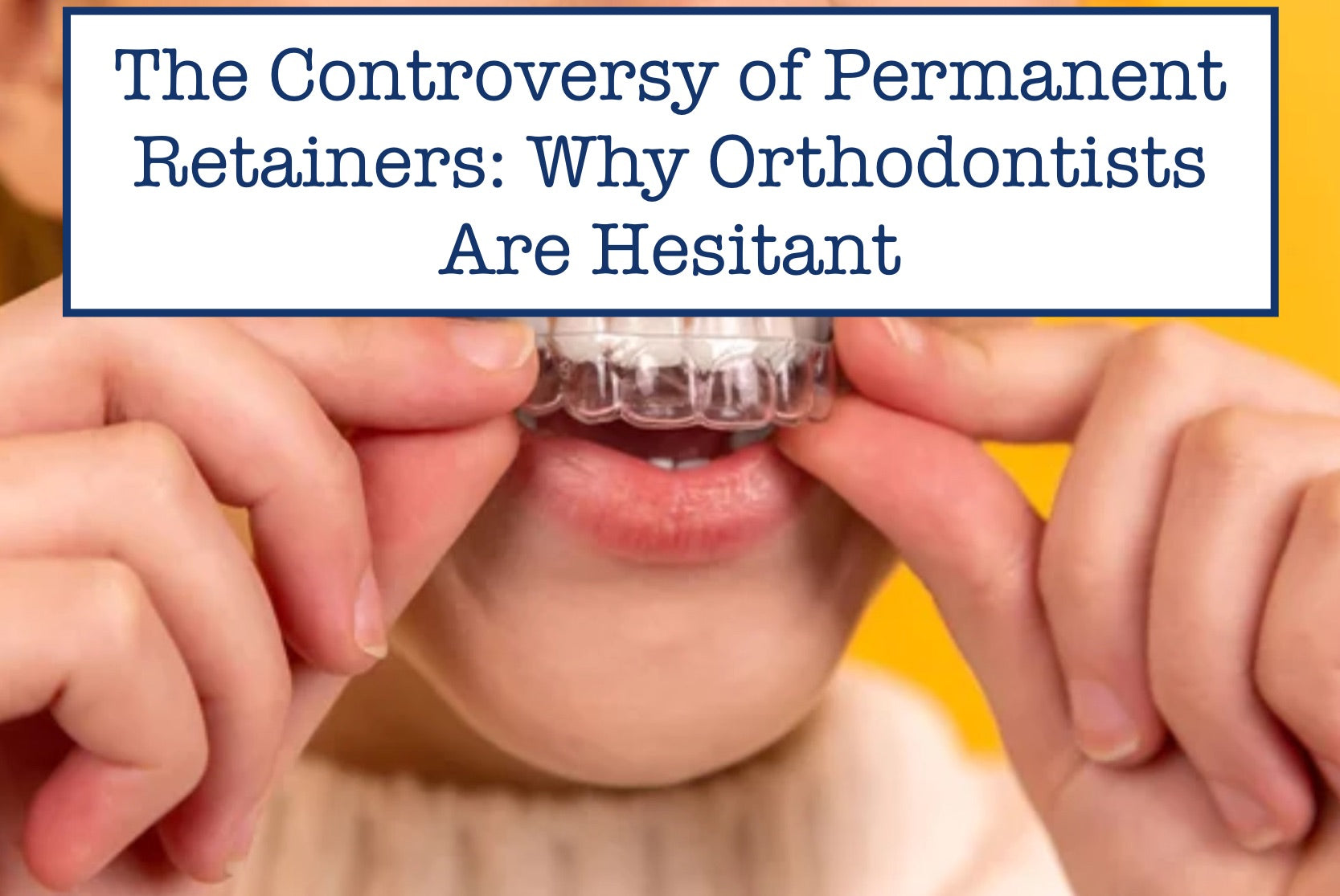 The Controversy of Permanent Retainers: Why Orthodontists Are Hesitant