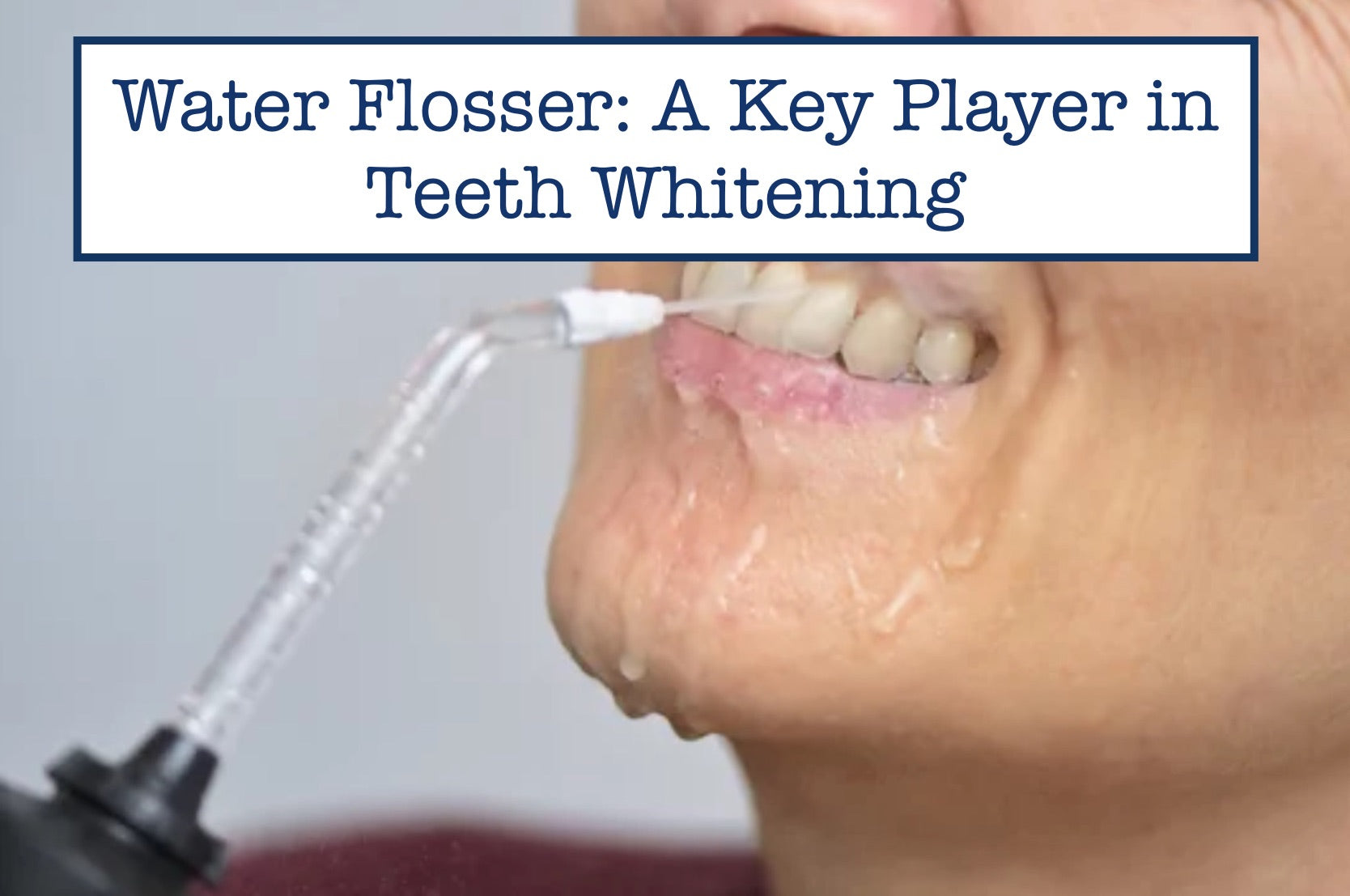 Water Flosser: A Key Player in Teeth Whitening