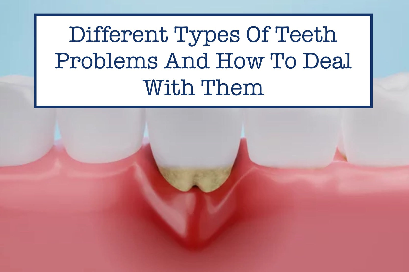 Different Types Of Teeth Problems And How To Deal With Them
