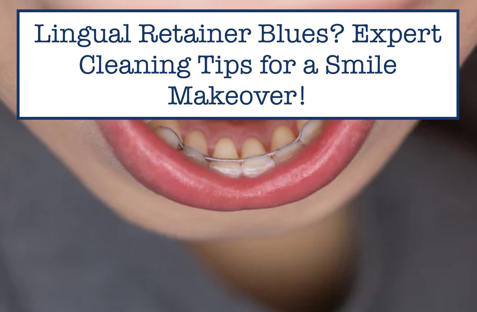 Lingual Retainer Blues? Expert Cleaning Tips for a Smile Makeover!