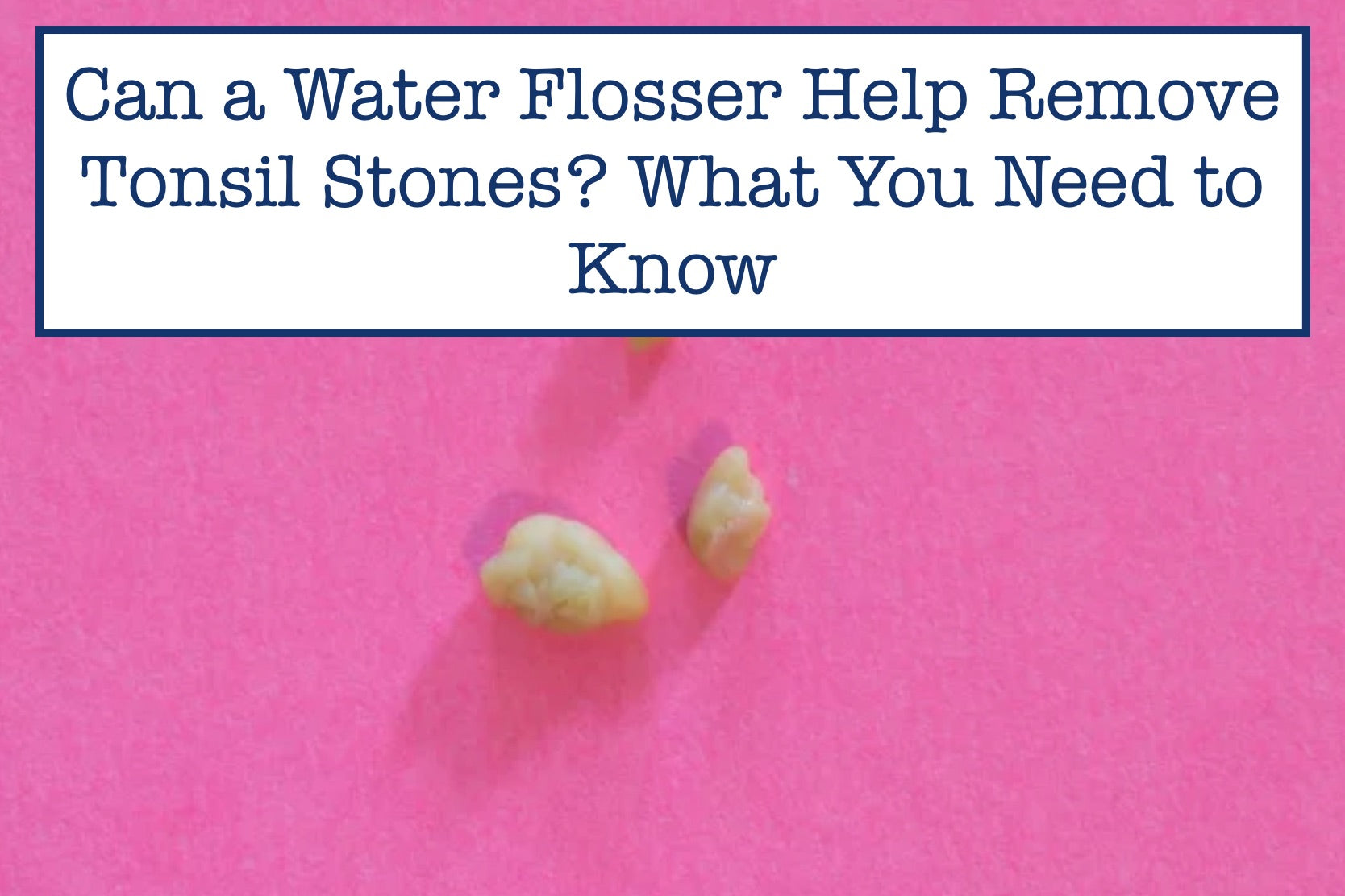 Can a Water Flosser Help Remove Tonsil Stones? What You Need to Know