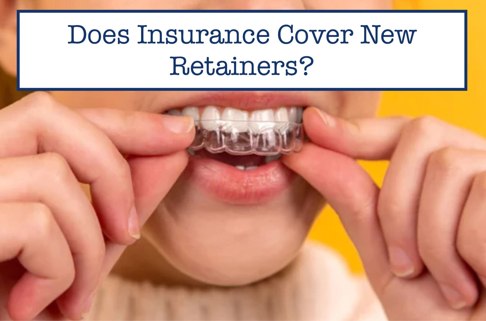 Does Insurance Cover New Retainers? – B.WEISS Health