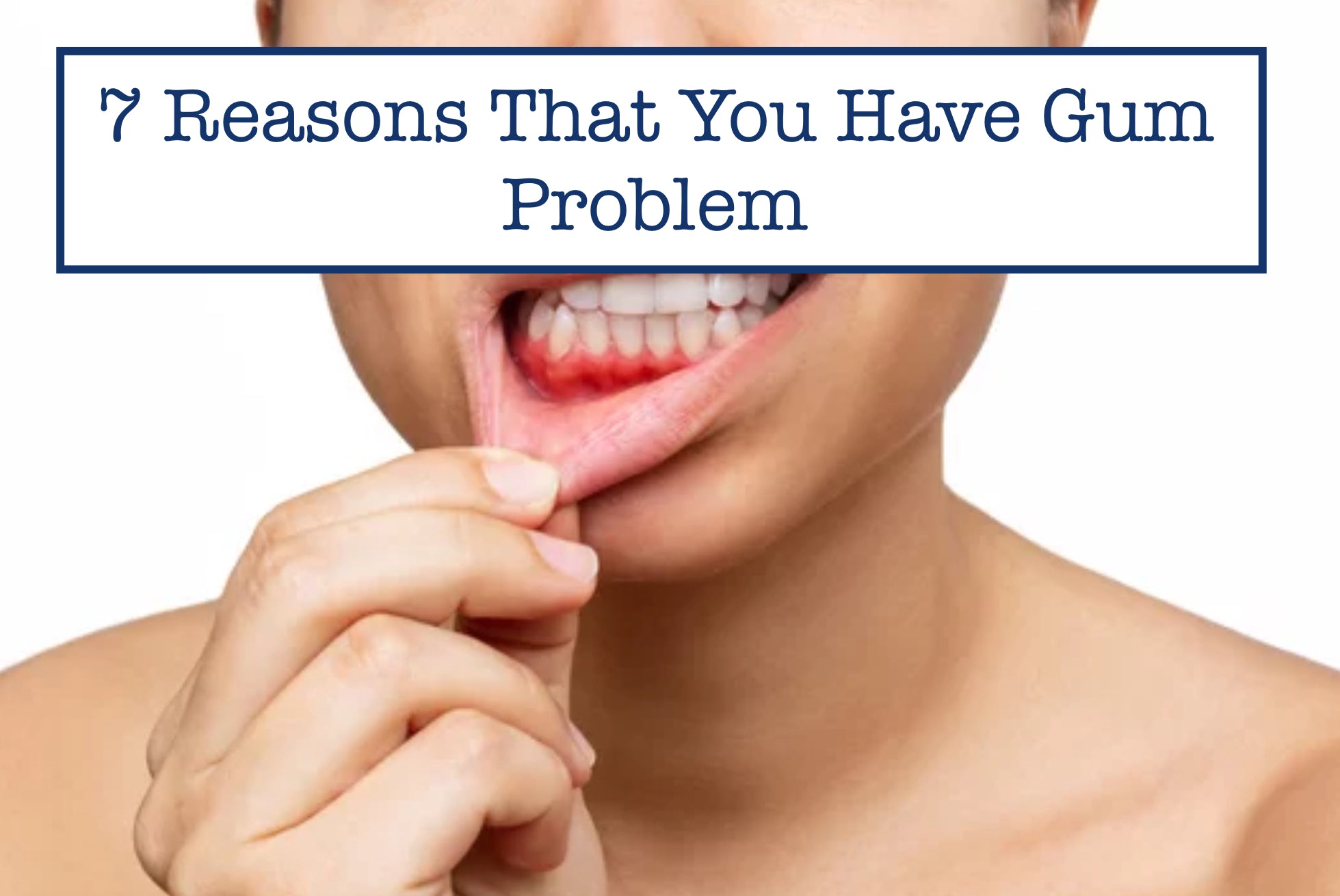 7 Reasons That You Have Gum Problem