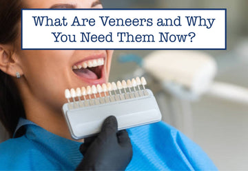 What Are Veneers and Why You Need Them Now
