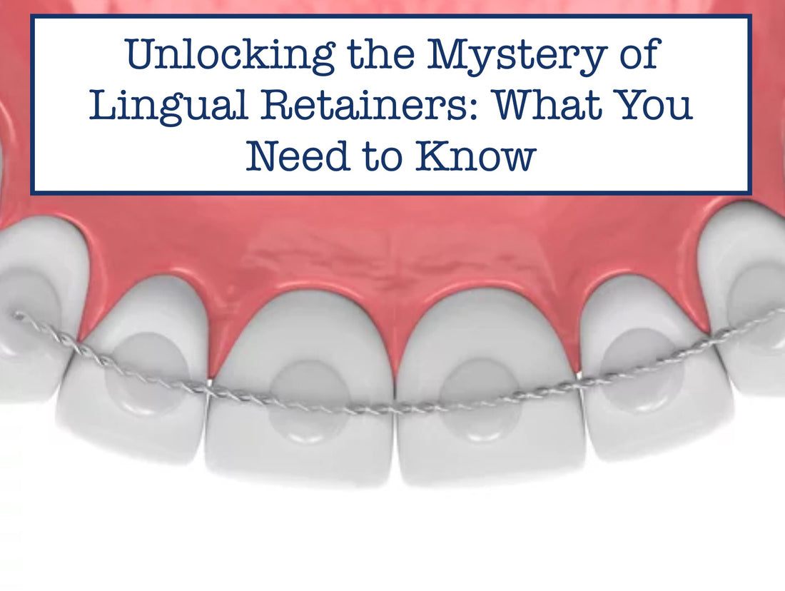 lingual retainers