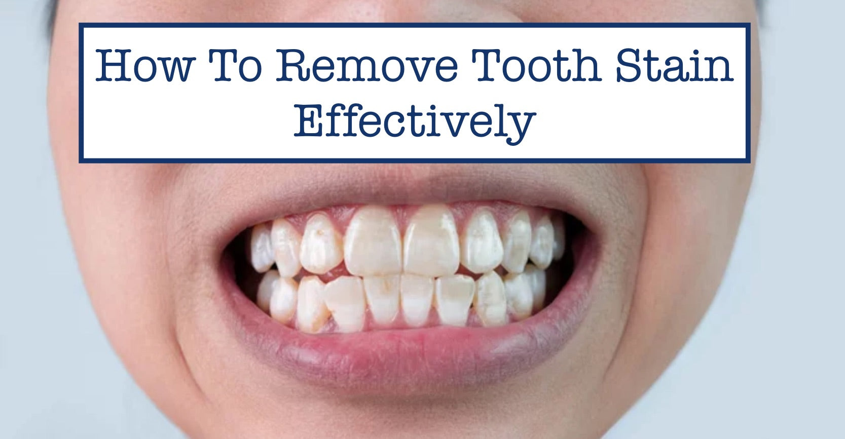 How To Remove Tooth Stain Effectively