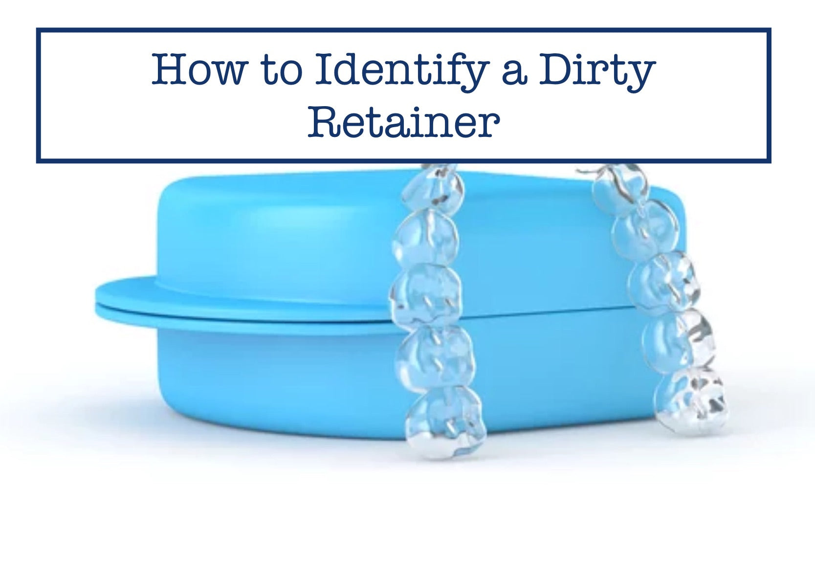 How to Identify a Dirty Retainer