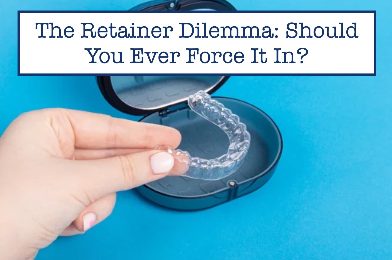 The Retainer Dilemma: Should You Ever Force It In?