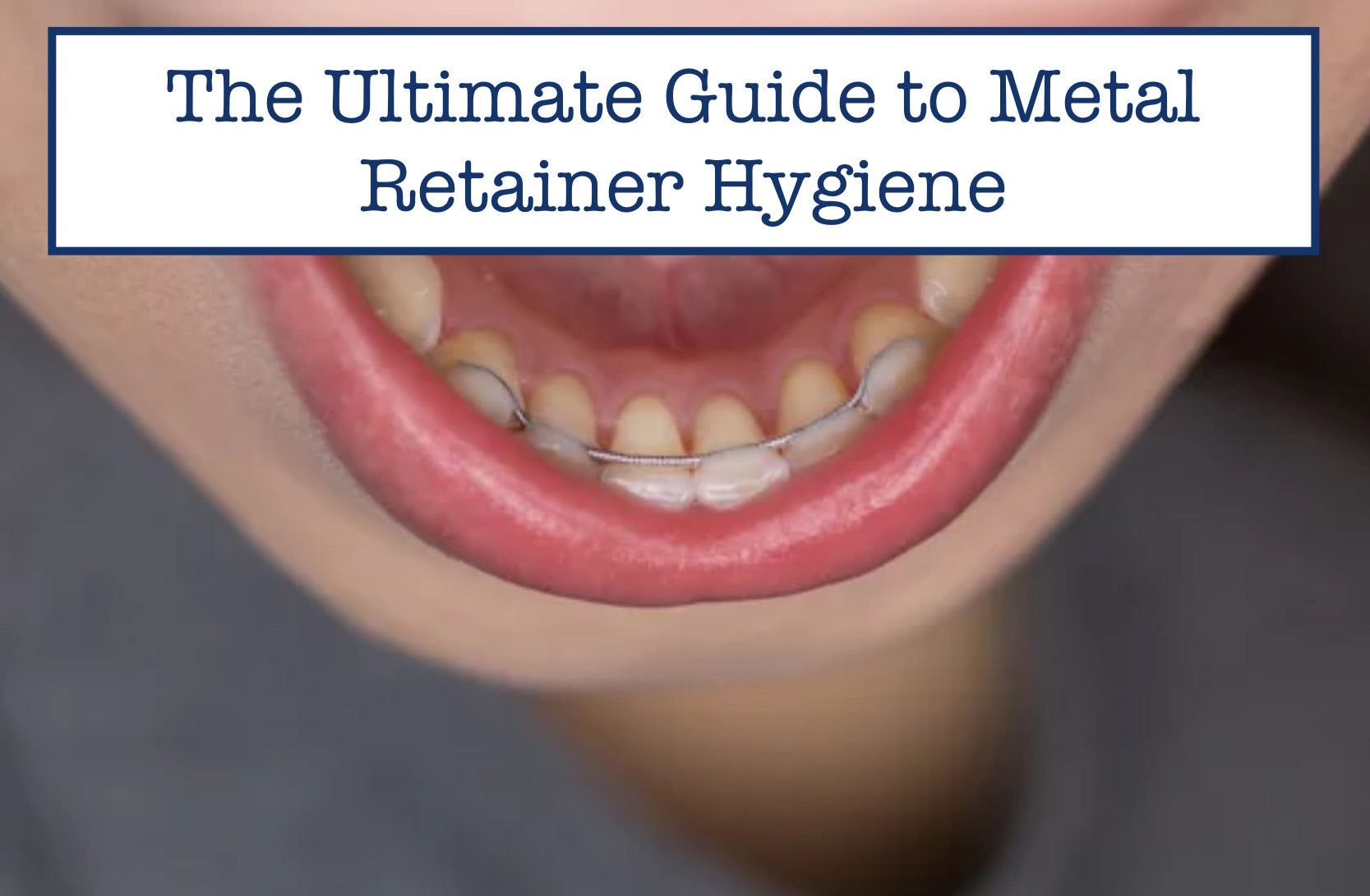 Clean Retainers How To Clean Metal Retainer | The Tube