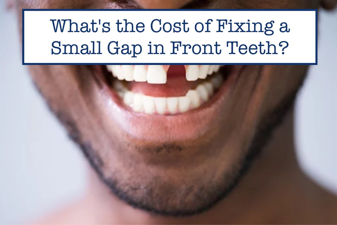 What's the Cost of Fixing a Small Gap in Front Teeth?