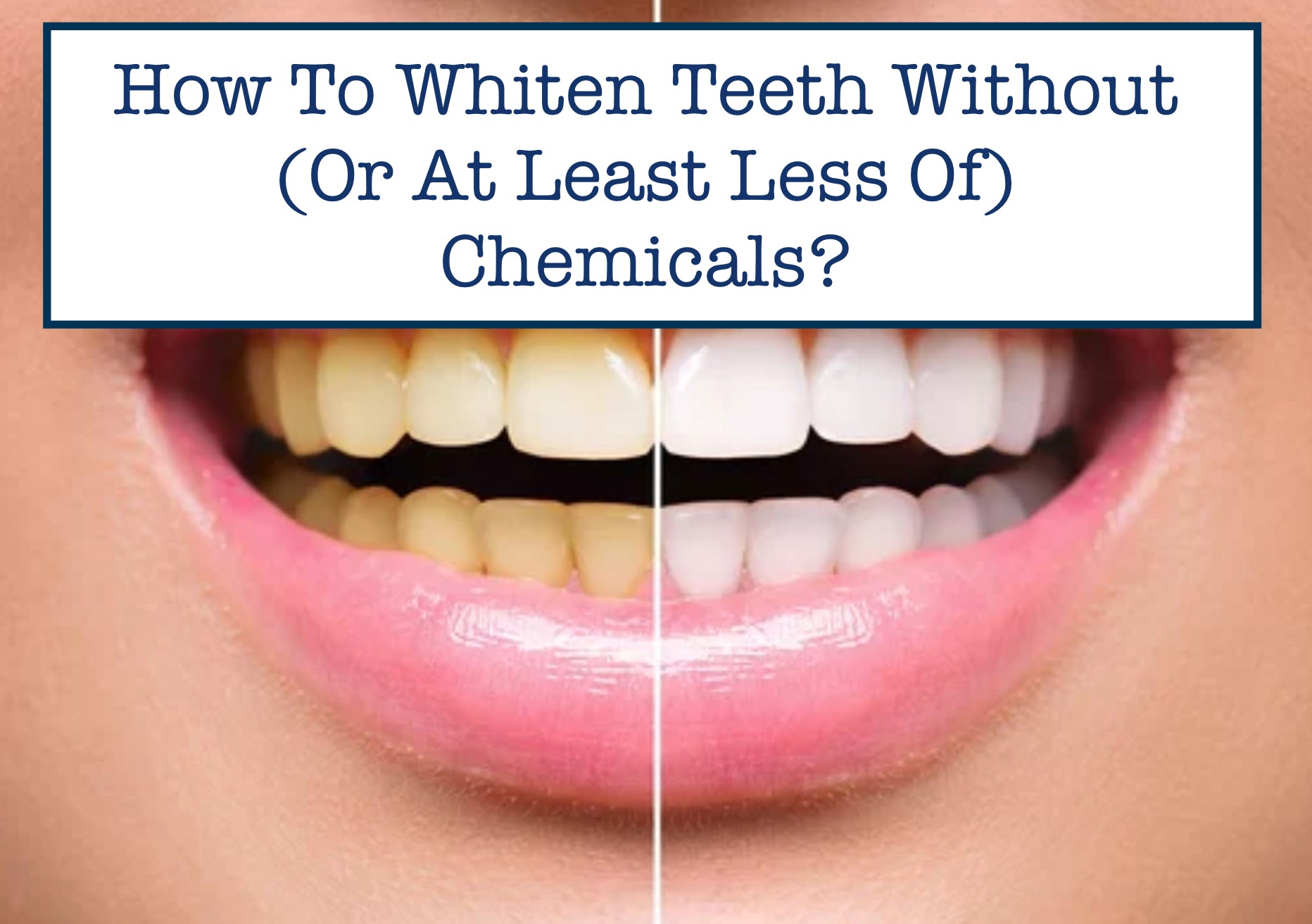 How To Whiten Teeth Without (Or At Least Less Of) Chemicals?