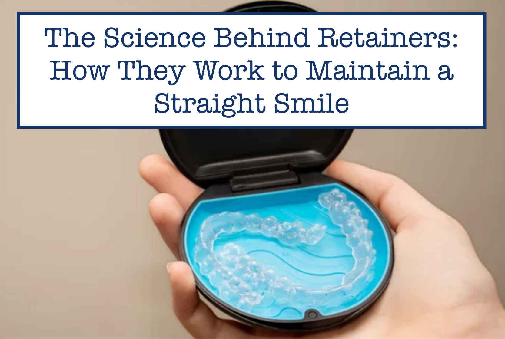 How Do Retainers Work to Maintain a Straight Smile