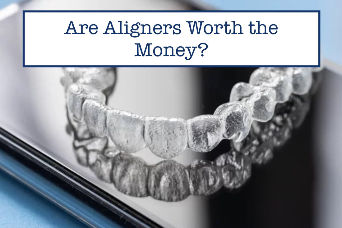 Are Aligners Worth the Money?