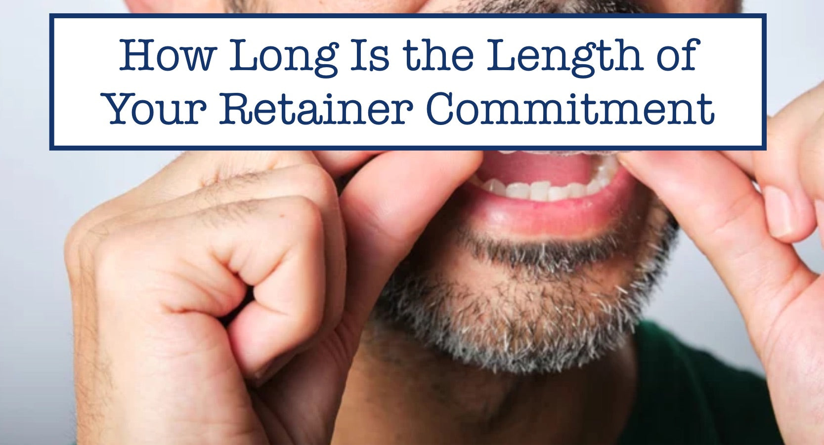 How Long Is the Length of Your Retainer Commitment