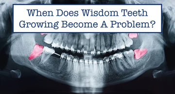When Does Wisdom Teeth Growing Become A Problem?