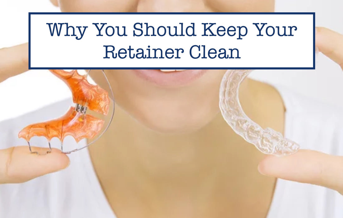 Why You Should Keep Your Retainer Clean