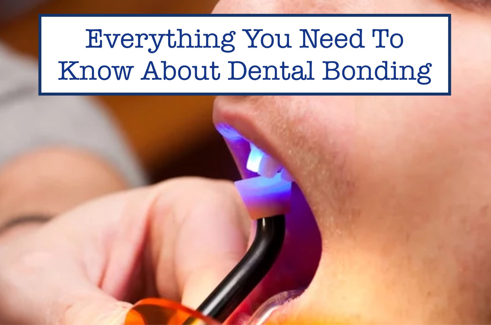 Everything You Need To Know About Dental Bonding