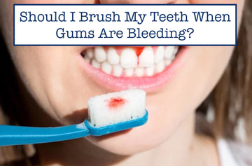 Should I Brush My Teeth When Gums Are Bleeding?
