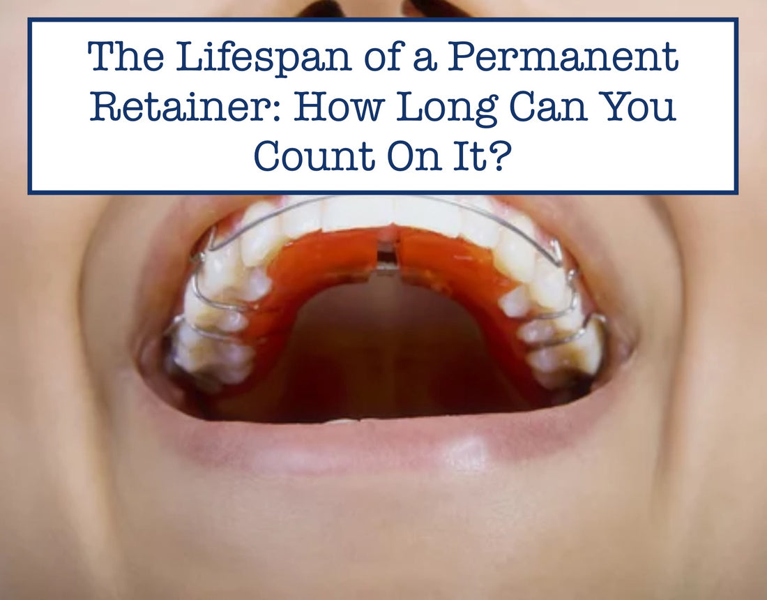 lifespan of permanent retainer