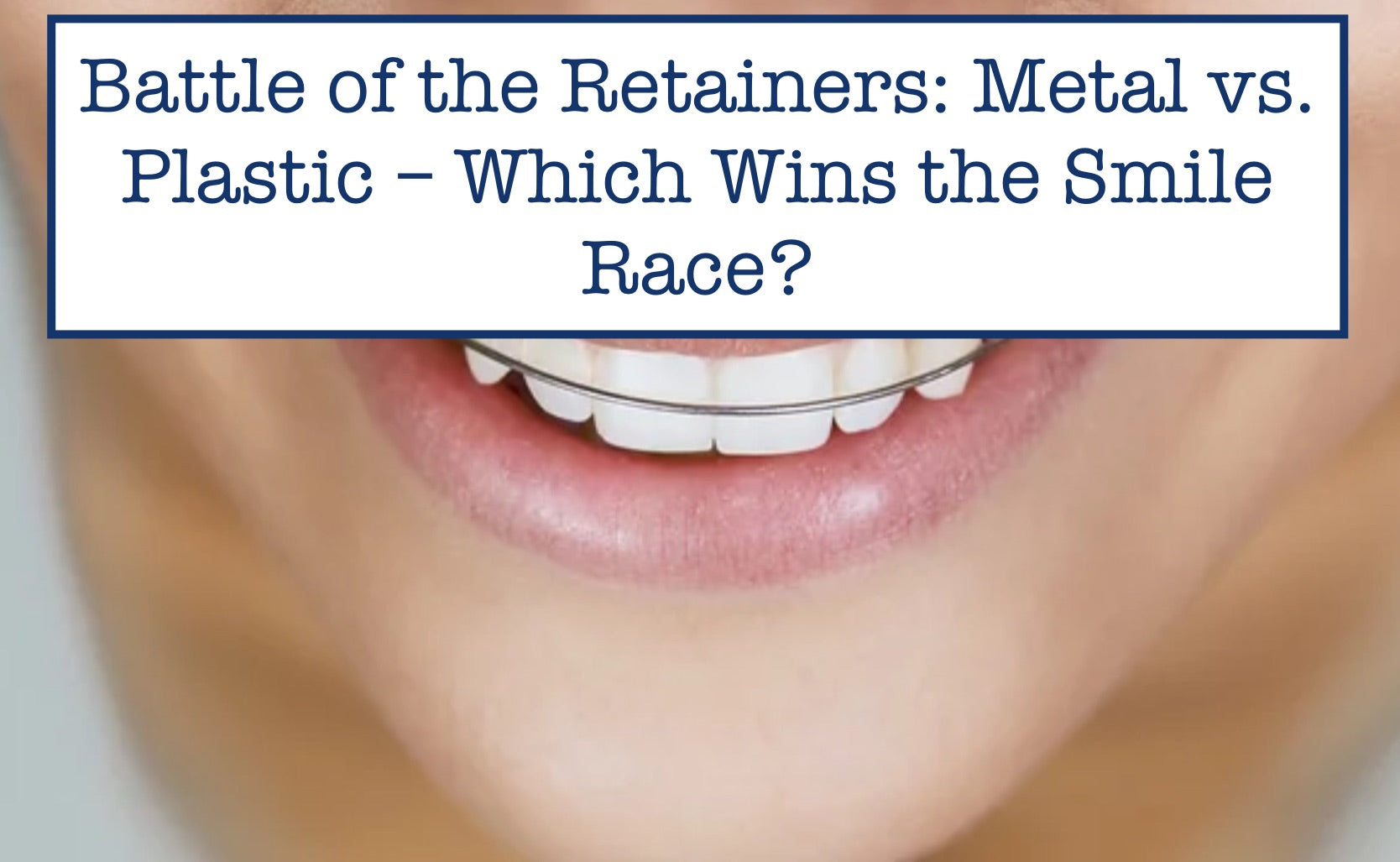 Battle of the Retainers: Metal vs. Plastic – Which Wins the Smile Race?