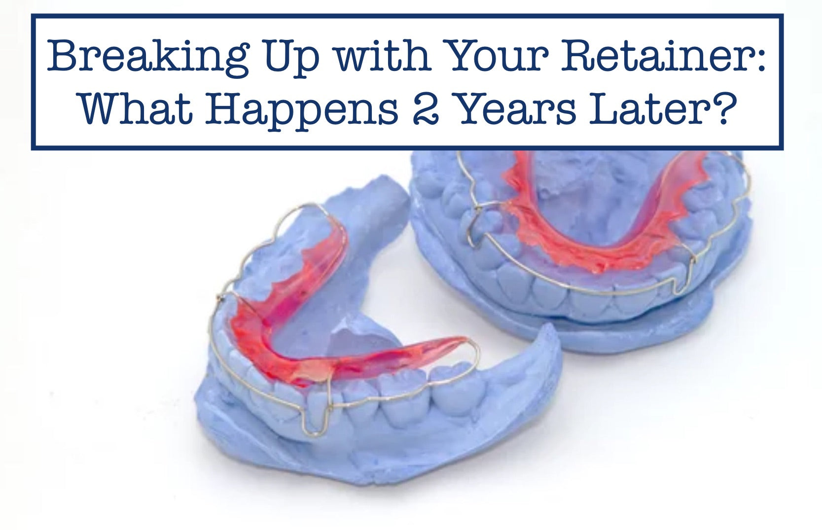 Breaking Up with Your Retainer: What Happens 2 Years Later?