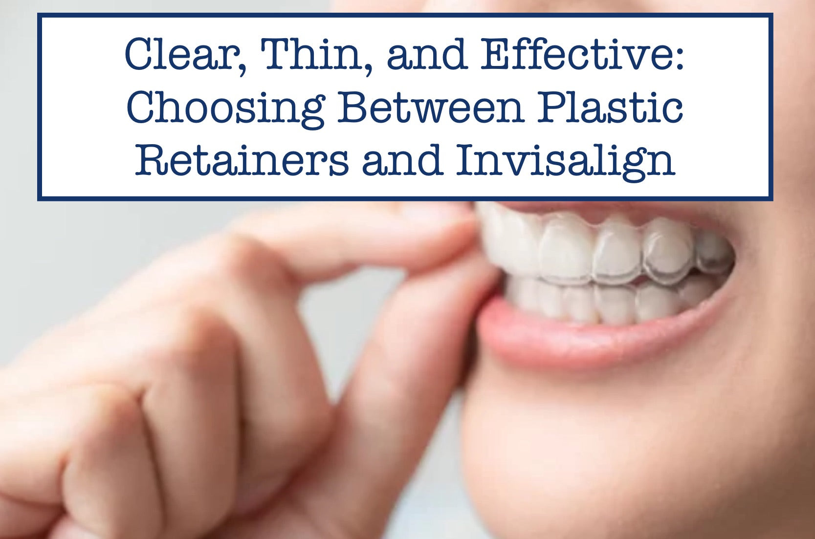 Retainers Vs Invasalign Choosing Between Plastic Retainers and Invisalign – B.WEISS Health