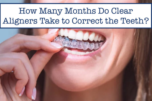 How Many Months Do Clear Aligners Take to Correct the Teeth?