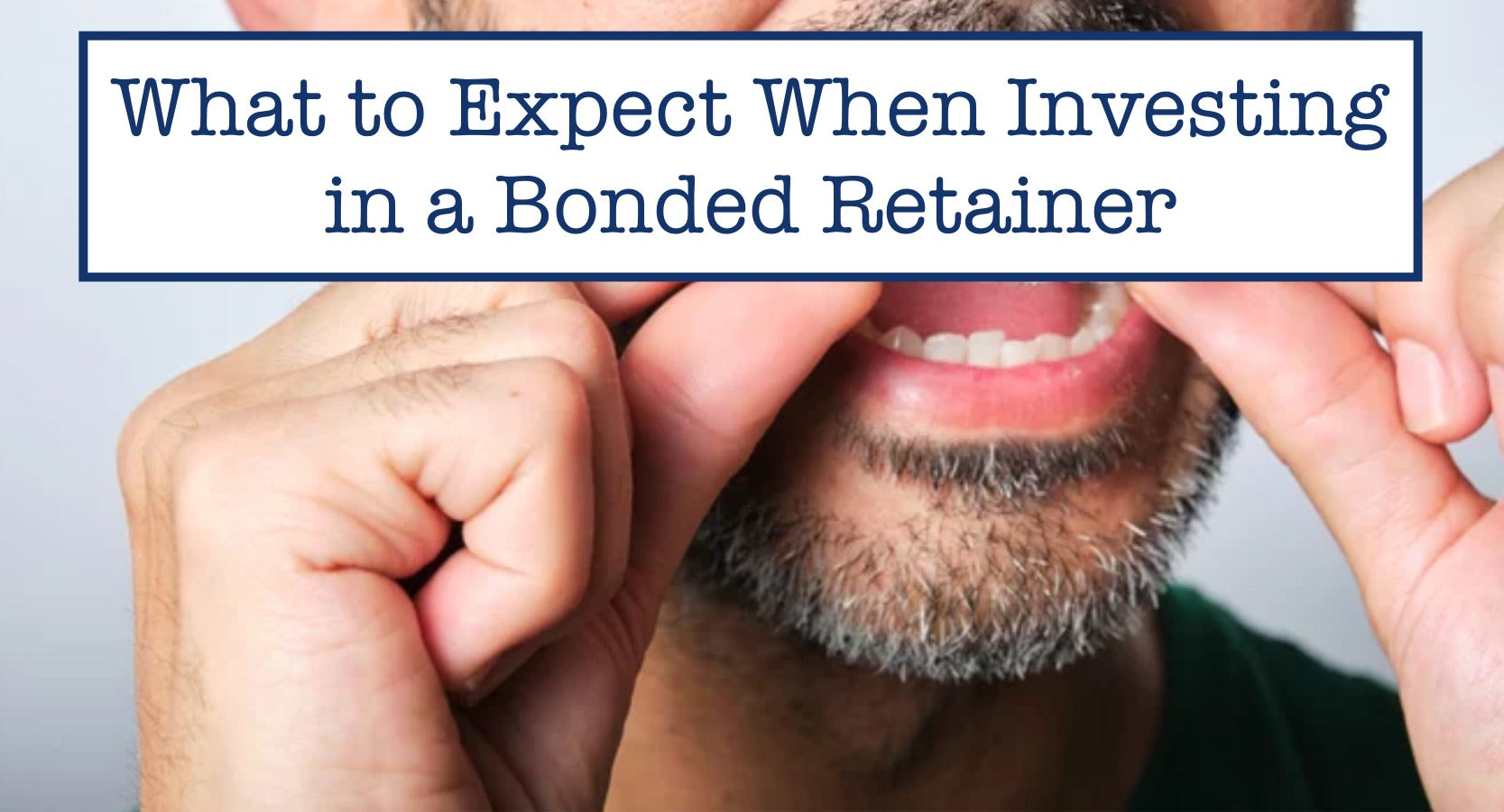 What to Expect When Investing in a Bonded Retainer – B.WEISS Health