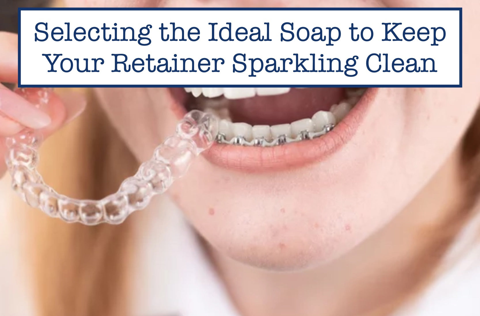 Selecting the Ideal Soap to Keep Your Retainer Sparkling Clean