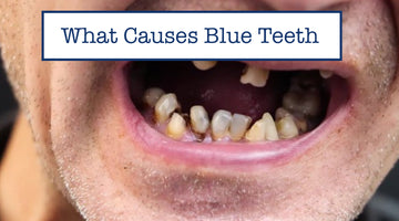 What Causes Blue Teeth