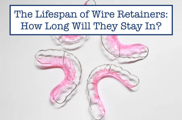 The Lifespan of Wire Retainers: How Long Will They Stay In?
