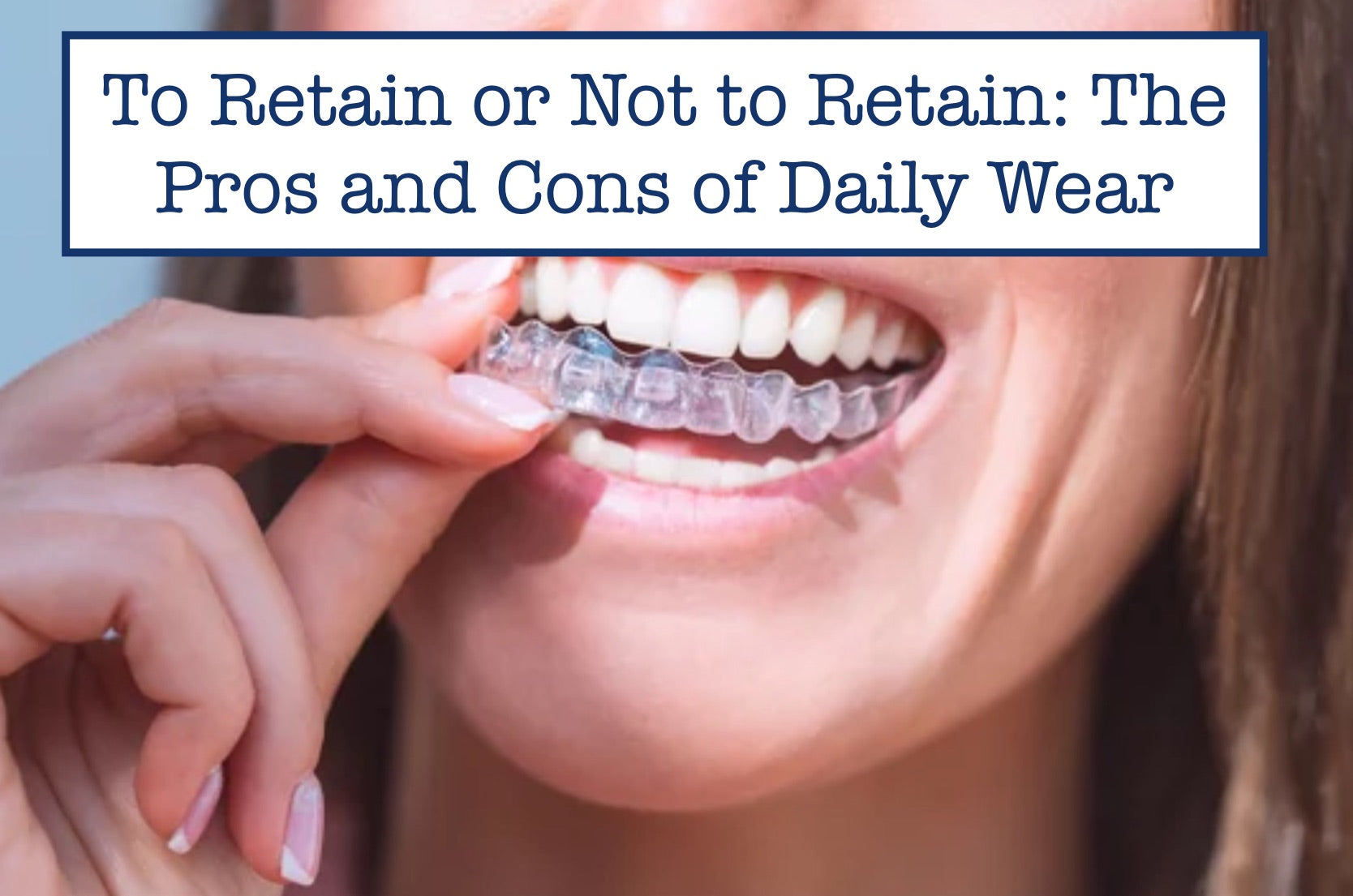 To Retain or Not to Retain: The Pros and Cons of Daily Wear