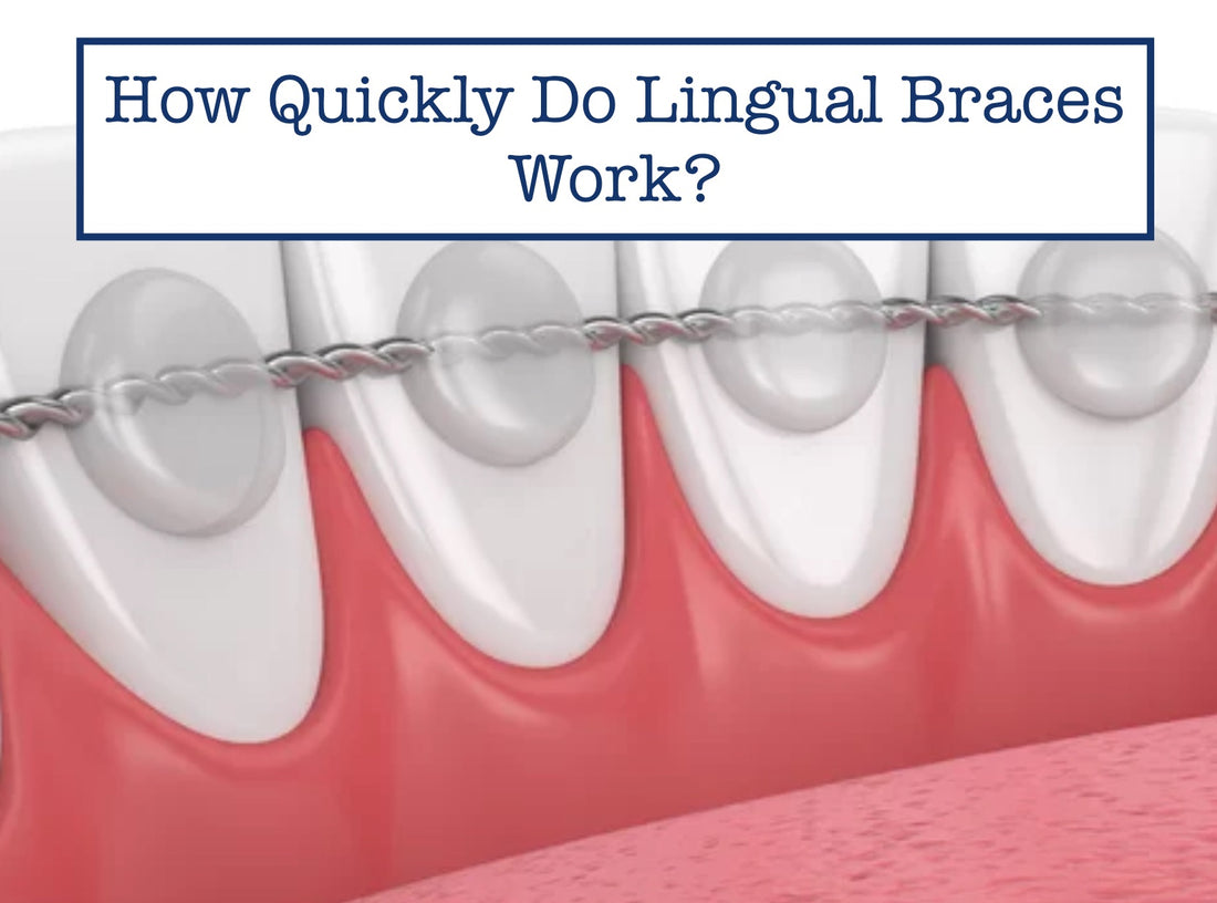 How Quickly Do Lingual Braces Work?