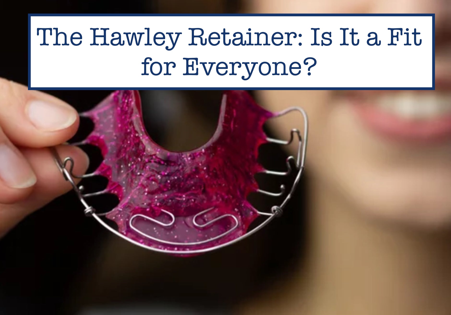 The Hawley Retainer: Is It a Fit for Everyone?