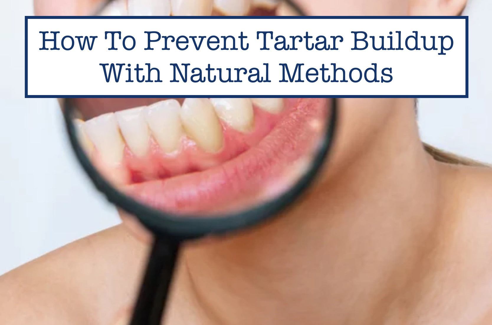 How To Prevent Tartar Buildup With Natural Methods