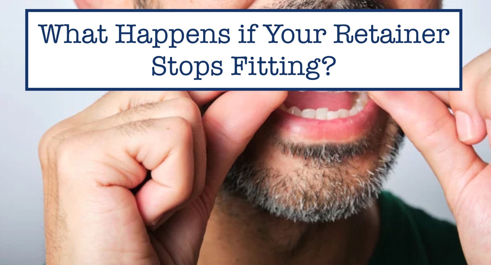 What Happens if Your Retainer Stops Fitting?