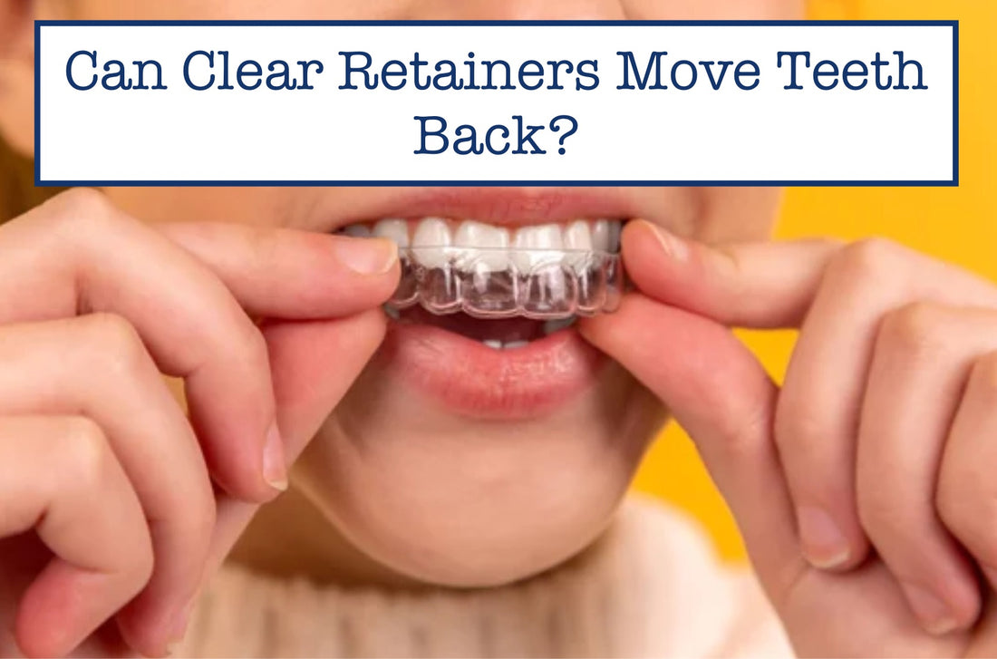 Retainers Moving Teeth Back