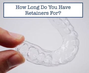 How Long Do You Have Retainers For?