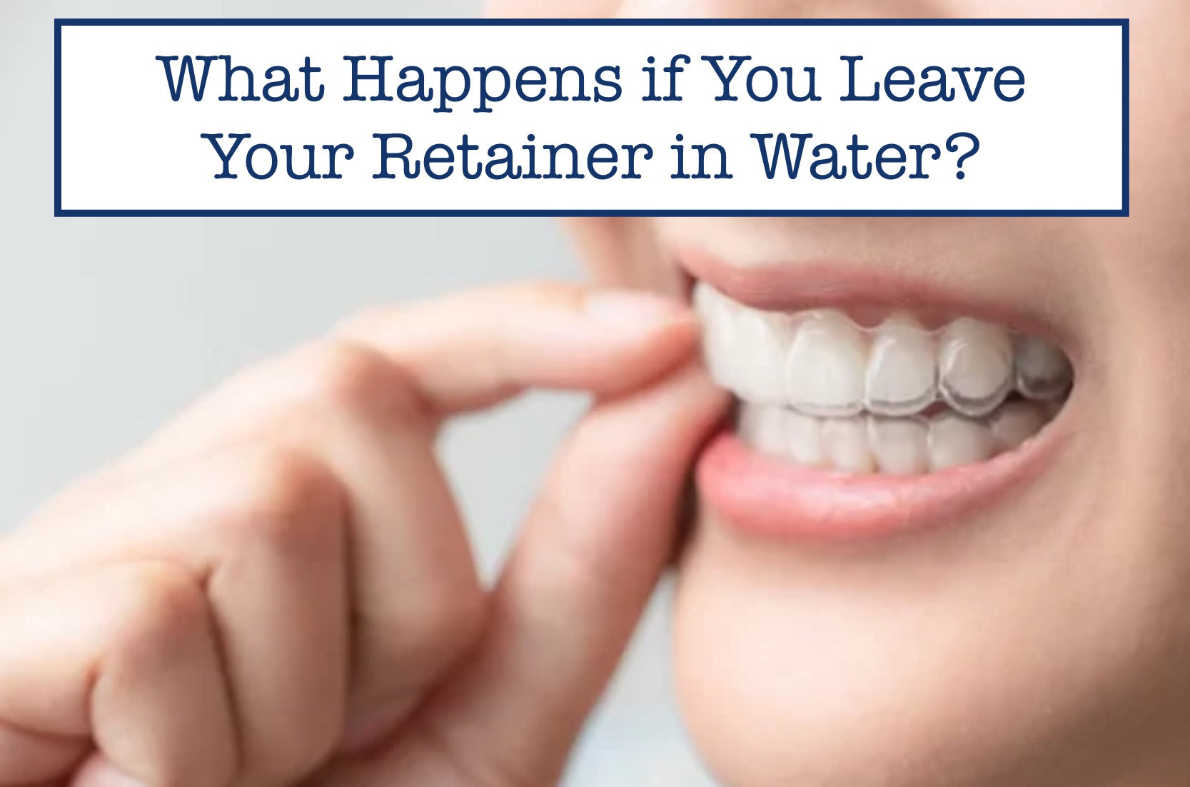 What Happens if You Leave Your Retainer in Water?