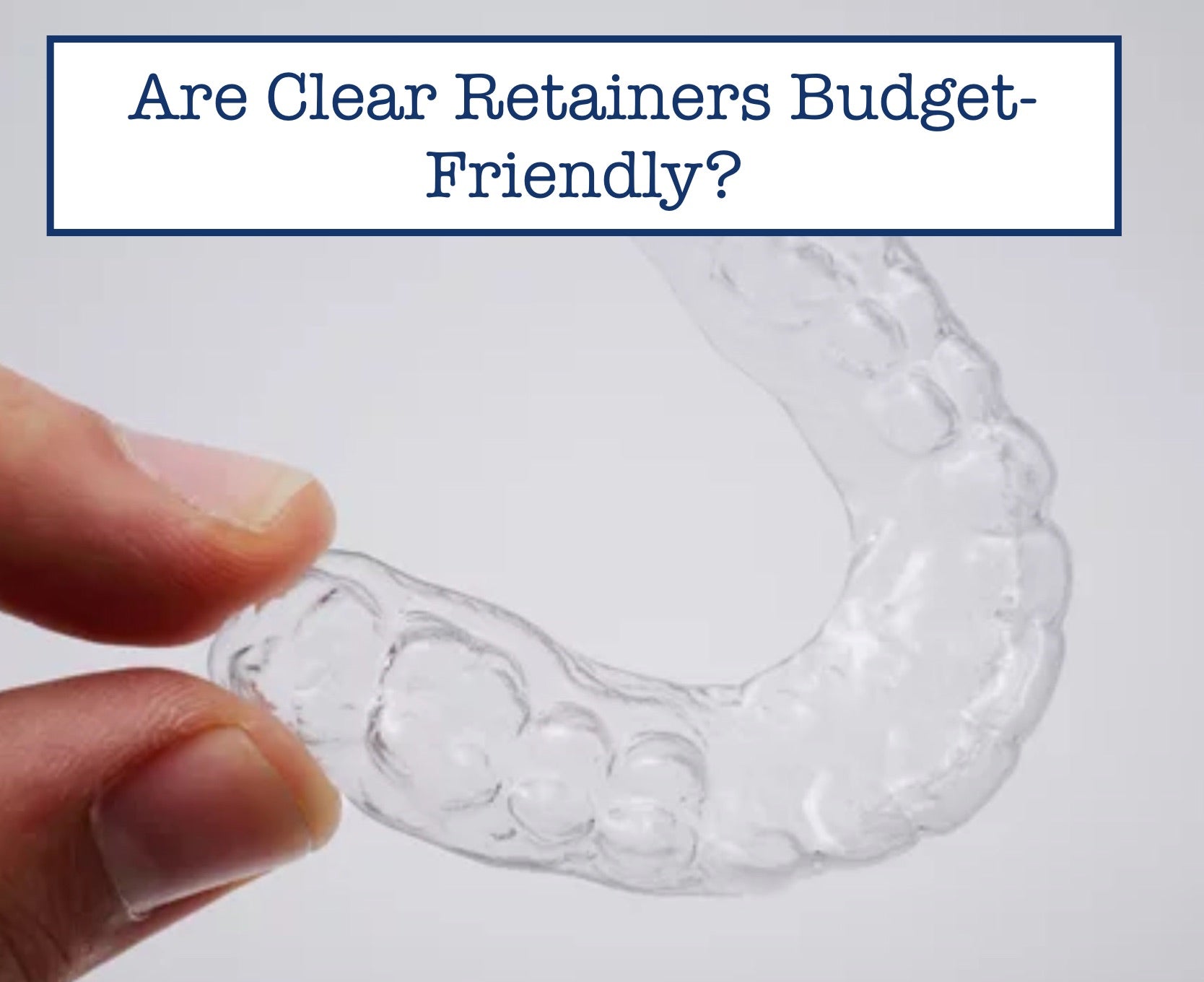 Are Clear Retainers Budget-Friendly?