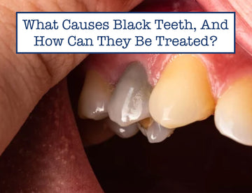 What Causes Black Teeth, And How Can They Be Treated?