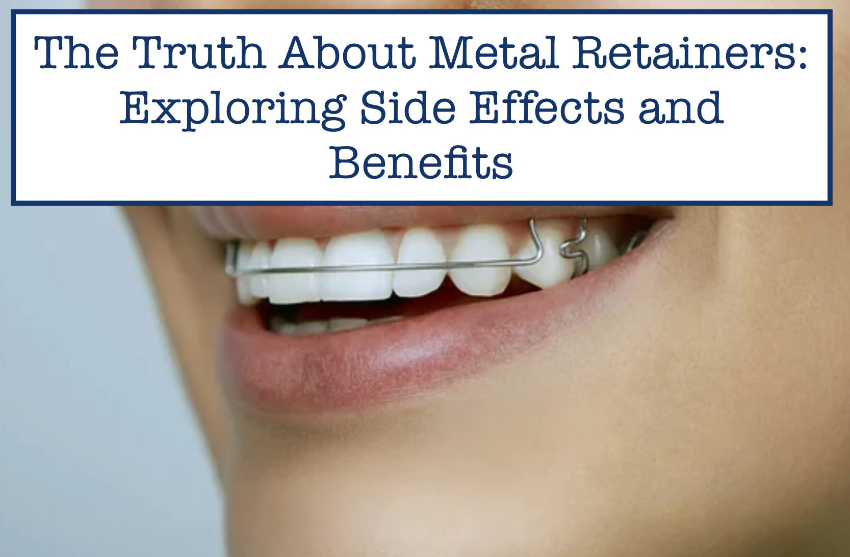 The Pros and Cons of Metal Retainers: What You Need to Know