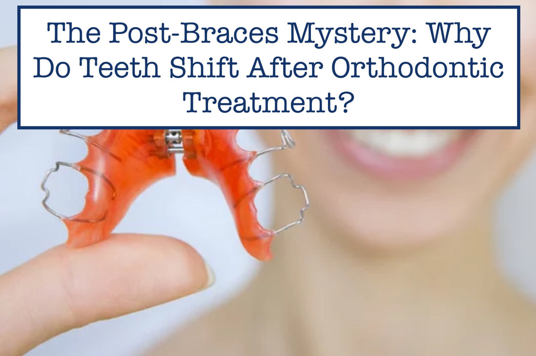 The Post-Braces Mystery: Why Do Teeth Shift After Orthodontic Treatment?