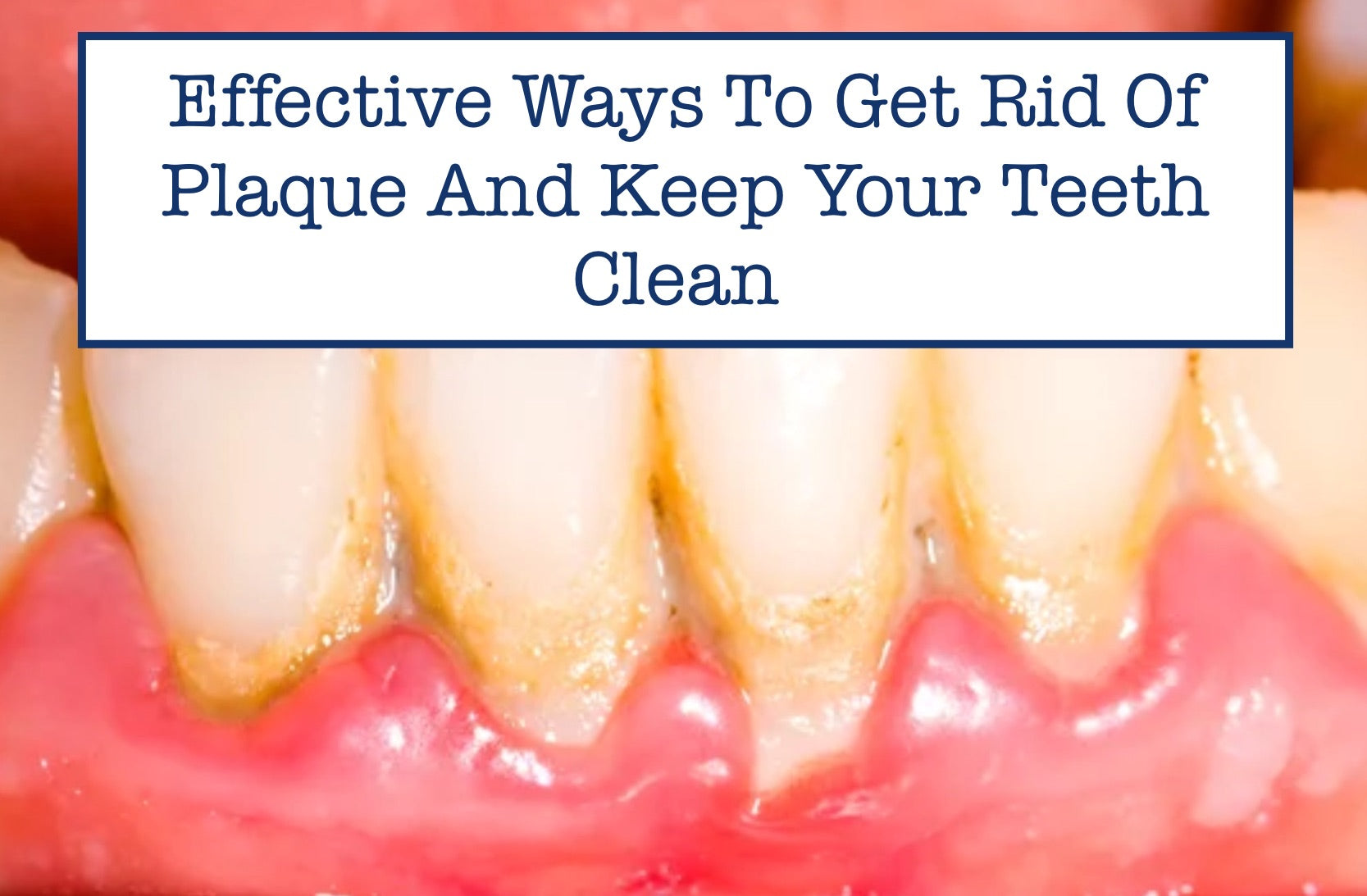 Effective Ways To Get Rid Of Plaque And Keep Your Teeth Clean 