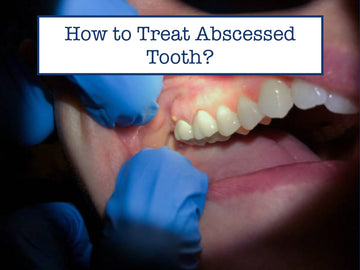 How to Treat Abscessed Tooth?