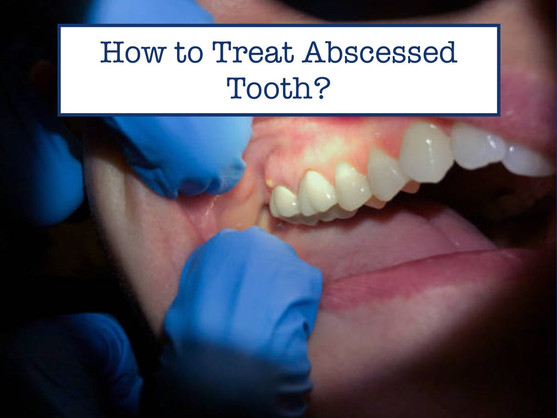 How to Treat Abscessed Tooth?